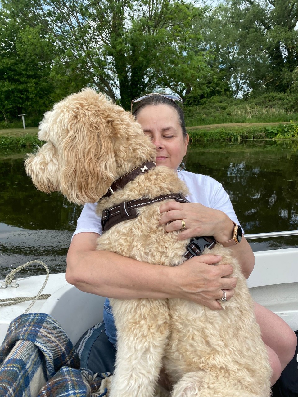 Candice hidradewnitis suppurativa story