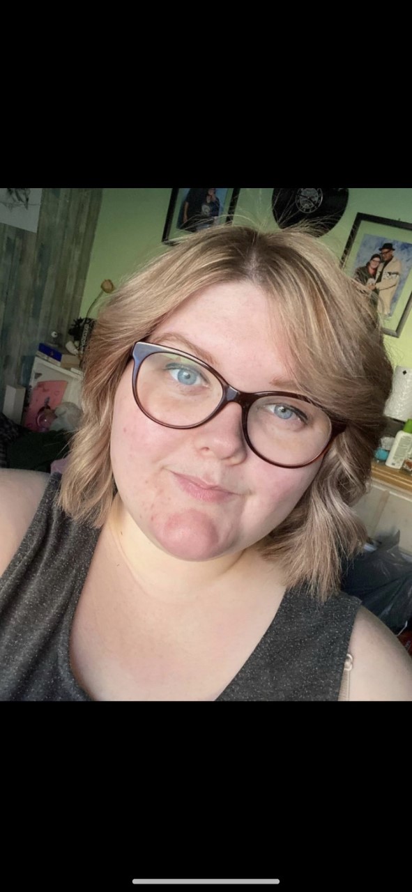 Lindsay hidradenitis suppurativa